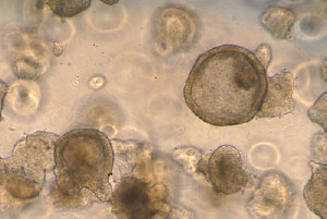 Human intestinal organoids