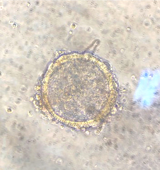 Mouse intestinal organoid